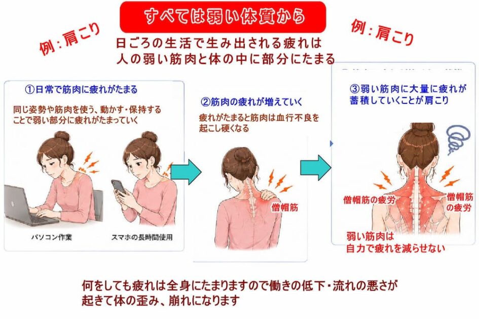 肩こりのおおもとの原因は弱い体質の問題。北九州市・小倉で徳力整体院。
